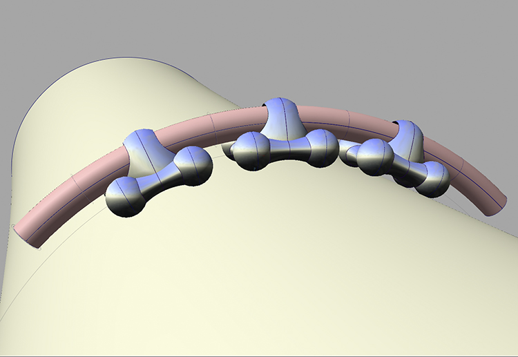 Cerclage_1_750.jpg
